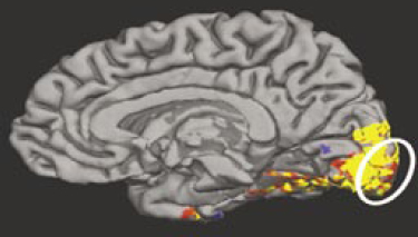 Image of the brain taken using fMRI