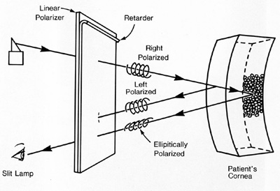 Ophthalmic applications of circular polarizers