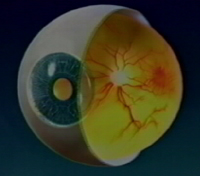 Hope In Sight aims to educate the viewer about the anatomy of the eye and how AMD affects it.  This segment was designed assuming essentially no familiarity with the anatomy of the eye.  It was also produced with special attention to the low vision of the intended audience by providing highly magnified views and verbal descriptions.